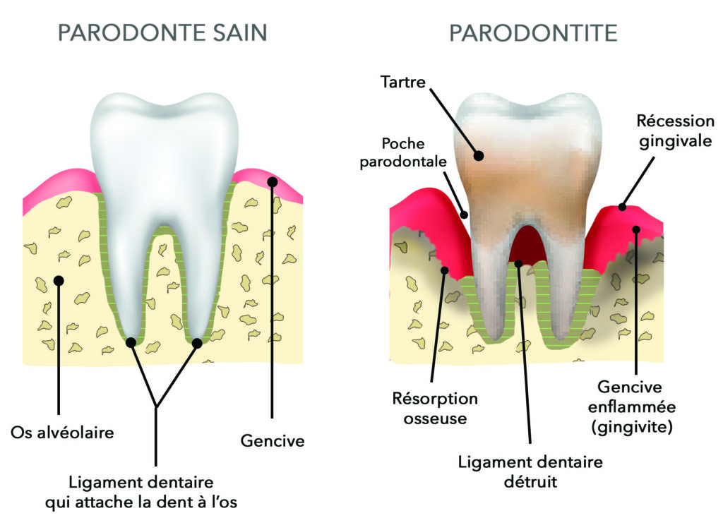 Traitements & greffes de gencives - Dr. François Maschino